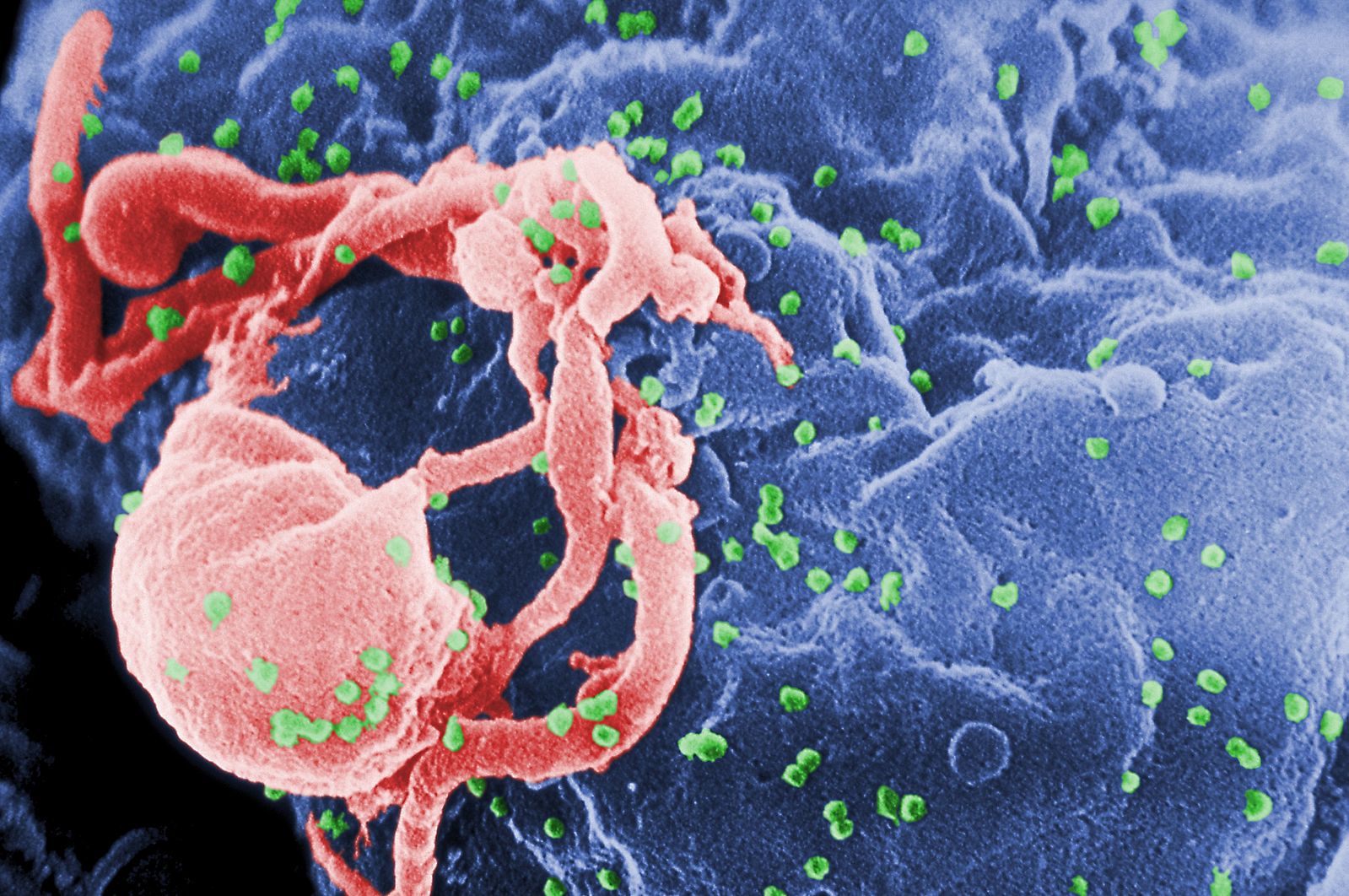 9 Mitos sobre el VIH y el SIDA
